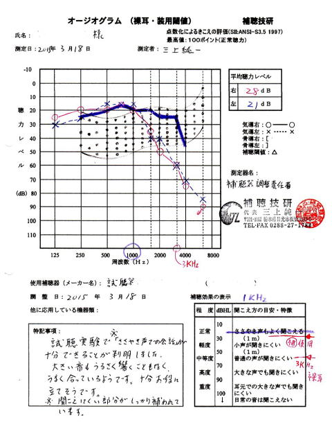 たった1回の調整でぴったりの聞こえになった方の例