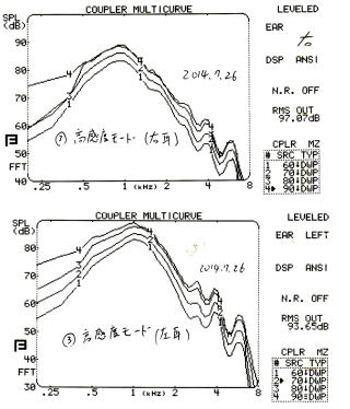 聞えに合わせた調整データ
